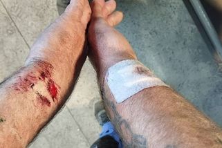 Muž z Rakovníka si stěžuje na policejní zákrok. Policie pochybení odmítá